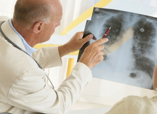 Tuberculoza, prima cauza de deces in Romania